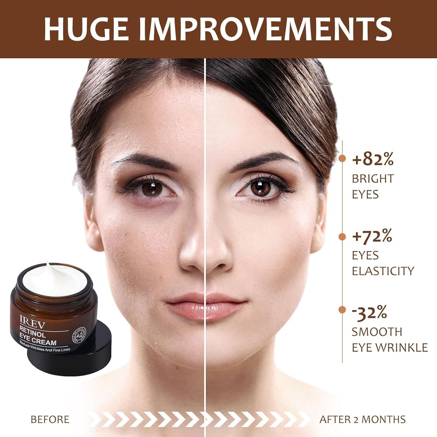 IREV- Retinol Eye Cream 100 ML EACH (PACK OF 2 )